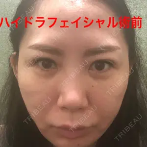 BIANCA銀座口コミ