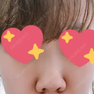オペラ整形外科口コミ