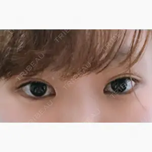 オペラ整形外科口コミ