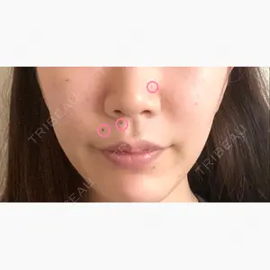 ツツイ美容外科口コミ