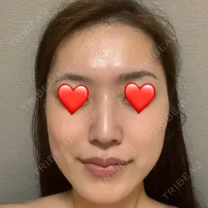 あつぎ美容クリニック口コミ
