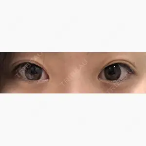 エートップ美容整形外科口コミ