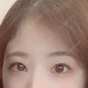 こまちクリニック口コミ
