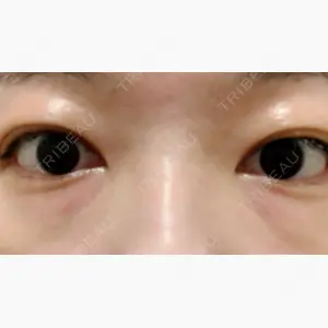 銀座みゆき通り美容外科 東京本院口コミ
