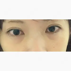 品川美容外科 新宿院（※品川スキンクリニック提携）口コミ