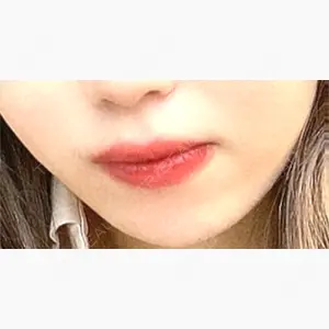 銀座フェイスクリニック（小顔整形・輪郭整形專門）口コミ