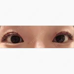 聖心美容クリニック 札幌院口コミ