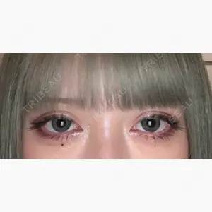 銀座ファインケアクリニック 銀座院口コミ
