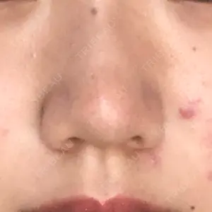 ツツイ美容外科口コミ