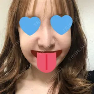 プリモ麻布十番クリニック口コミ