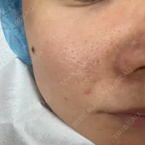 東京ブランシェクリニック口コミ