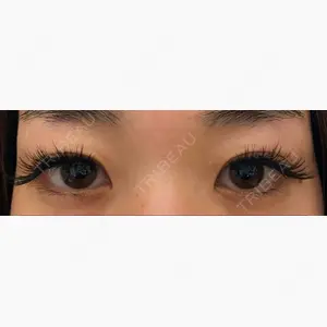 心斎橋コムロ美容外科クリニック口コミ