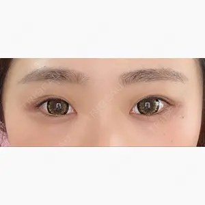 心斎橋コムロ美容外科クリニック口コミ