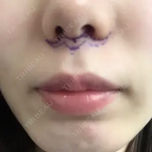 聖心美容クリニック 名古屋院口コミ