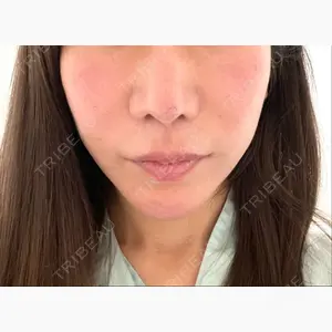 加藤クリニック麻布 東京院口コミ