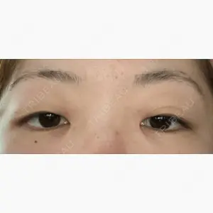 高田眼科併設眼瞼下垂治療センター口コミ