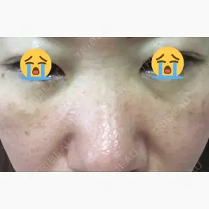 品川スキンクリニック表参道院口コミ