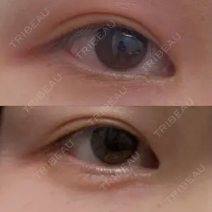 湘南美容クリニック 広島院口コミ