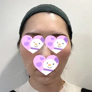 湘南美容クリニック 新宿本院口コミ