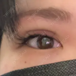 TCB東京中央美容外科 町田院口コミ