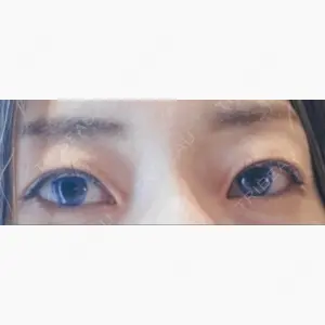 シエルクリニック口コミ