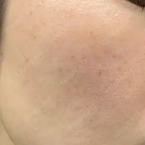 品川美容外科 札幌院口コミ