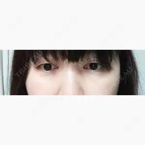 湘南美容クリニック 大阪心斎橋院口コミ