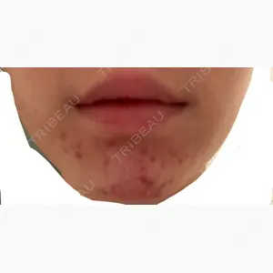 品川スキンクリニック表参道院口コミ