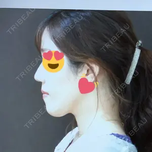 ヤスミクリニック口コミ