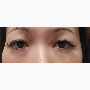 品川スキンクリニック広島院口コミ