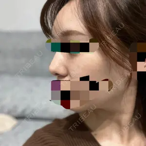 高崎美容クリニック口コミ