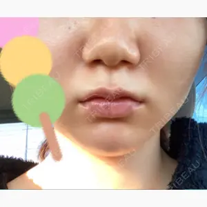 高崎美容クリニック口コミ