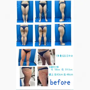 水の森美容クリニック 東京新宿院口コミ