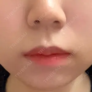 聖心美容クリニック 大阪院口コミ