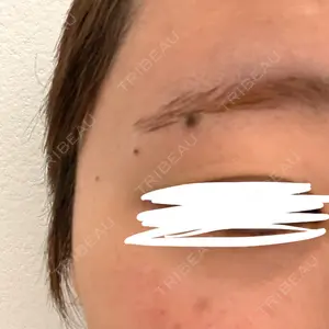 KOBE美容皮膚科 西宮院口コミ