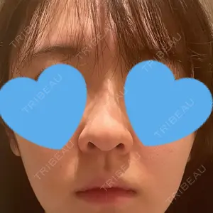 ザ・プラス美容外科 東京代官山院口コミ