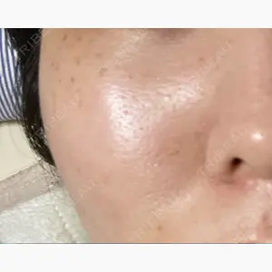 品川スキンクリニック表参道院口コミ