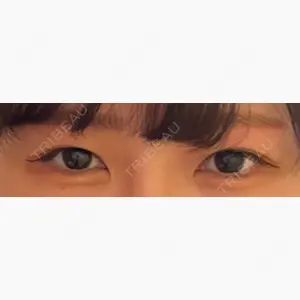サラ美容外科口コミ