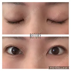 L’or Clinic Omotesando口コミ