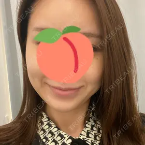 東京イセアクリニック口コミ