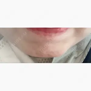 湘南美容クリニック 大阪あべの院口コミ