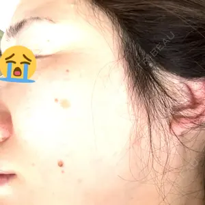 The Natural Beauty Clinic 四ツ橋院口コミ