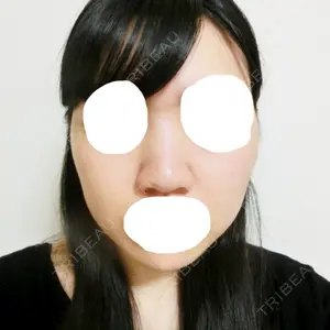 ヒルズ美容クリニック口コミ