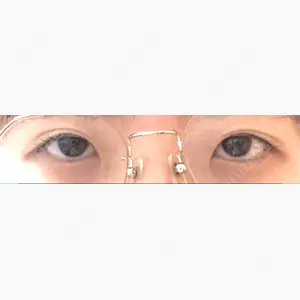 いちのせ形成外科・皮膚科 眼瞼＆フェイスクリニック口コミ