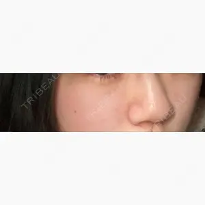 神戸ルミナスクリニック口コミ