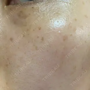 渋谷美容外科クリニック 渋谷院口コミ