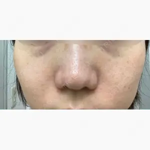 JMスマイルクリニック口コミ