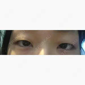 みやざき美容クリニック口コミ