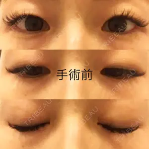 ヴェリィ美容形成クリニック口コミ