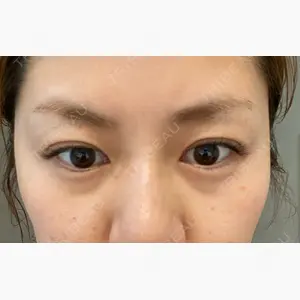 BIANCA表参道口コミ